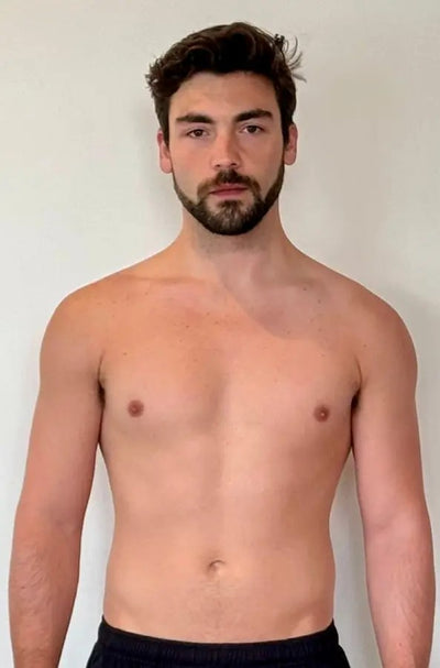 Przed – Tomasz B.